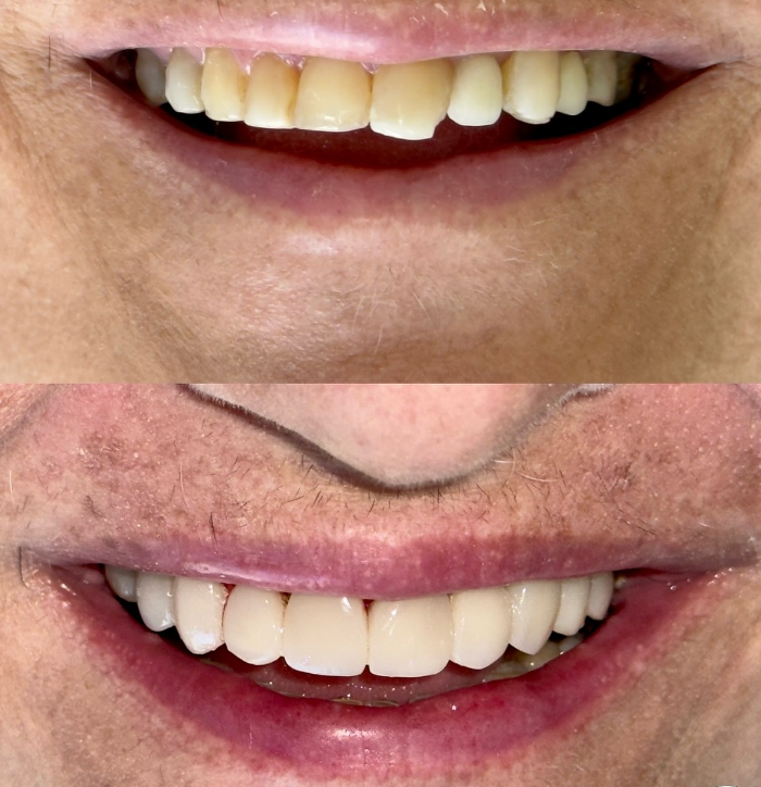 Foto Resultado