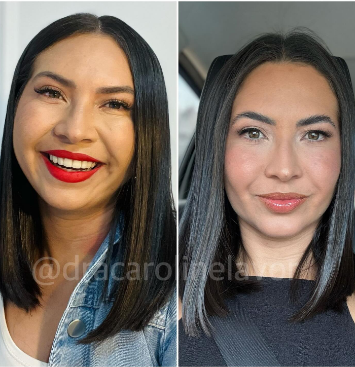 Foto Resultado